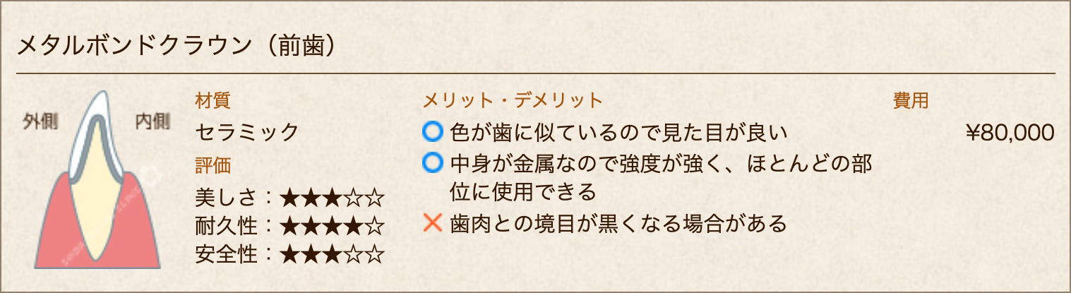 メタルボンドクラウン(前歯)