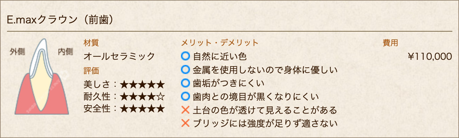E.maxクラウン(前歯)