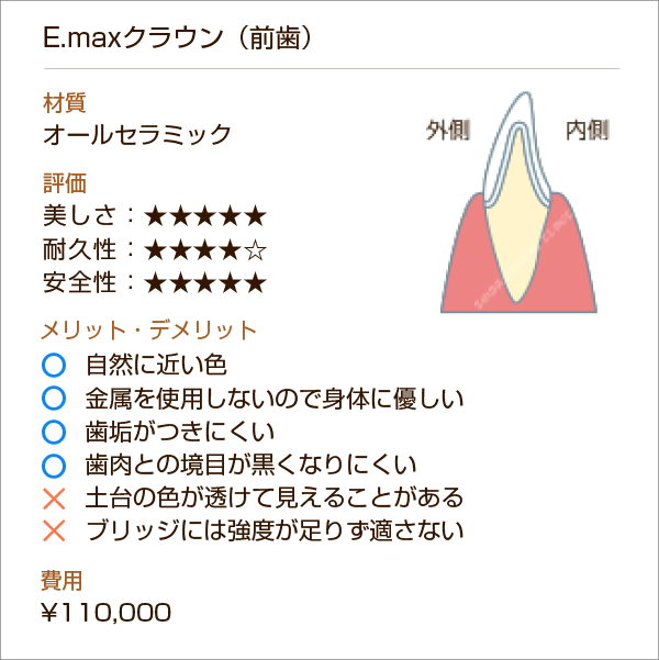 E-maxクラウン（前歯）