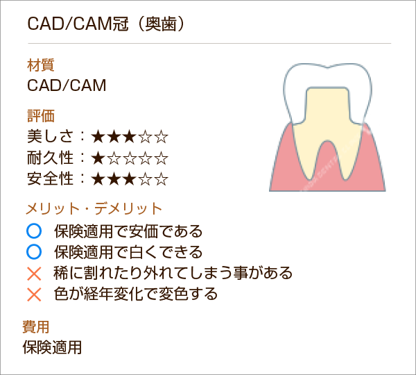 CAD/CAM冠（奥歯）