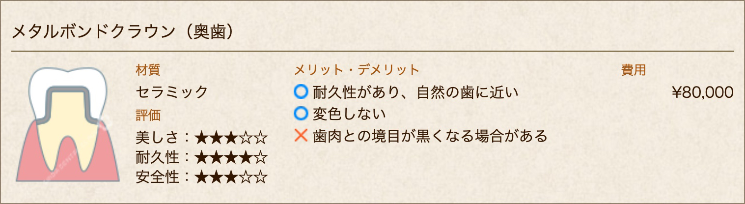 メタルボンドクラウン(奥歯)