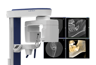歯科用CT